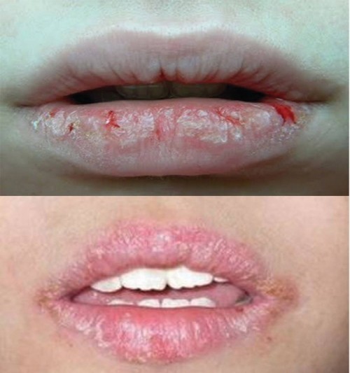 6 hậu quả để lại khi xăm, phun môi