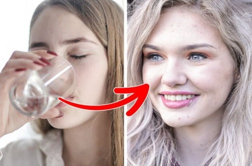 10 điều kỳ diệu xảy ra với da khi uống nước ấm mỗi ngày