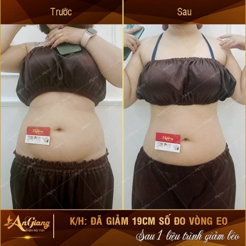 3 Spa làm đẹp uy tín nhất Bỉm Sơn, Thanh Hóa