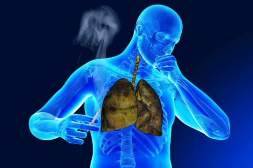 8 Lưu ý quan trọng nhất về bệnh lao phổi