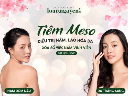 6 spa trị nám tốt nhất tp. đà lạt, lâm đồng