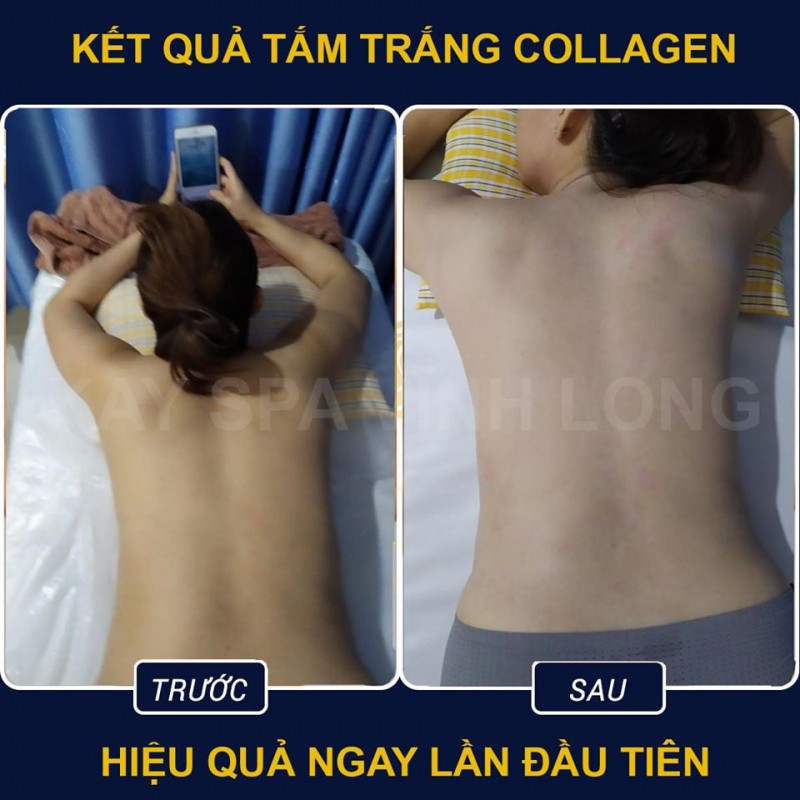 5 spa tắm trắng uy tín nhất vĩnh long