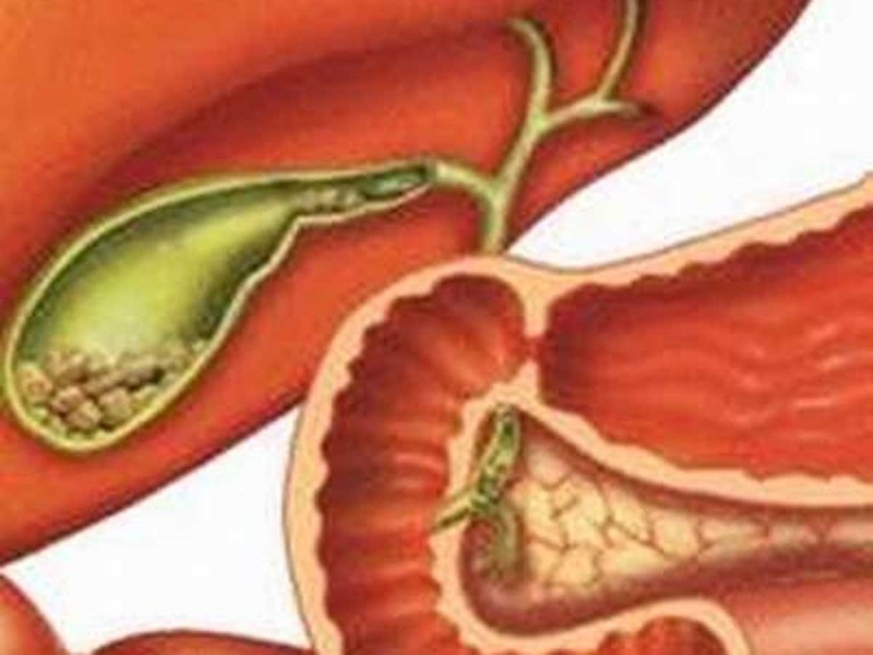 10 nguyên nhân gây đau bụng thường gặp nguy hiểm nhất bạn cần chú ý