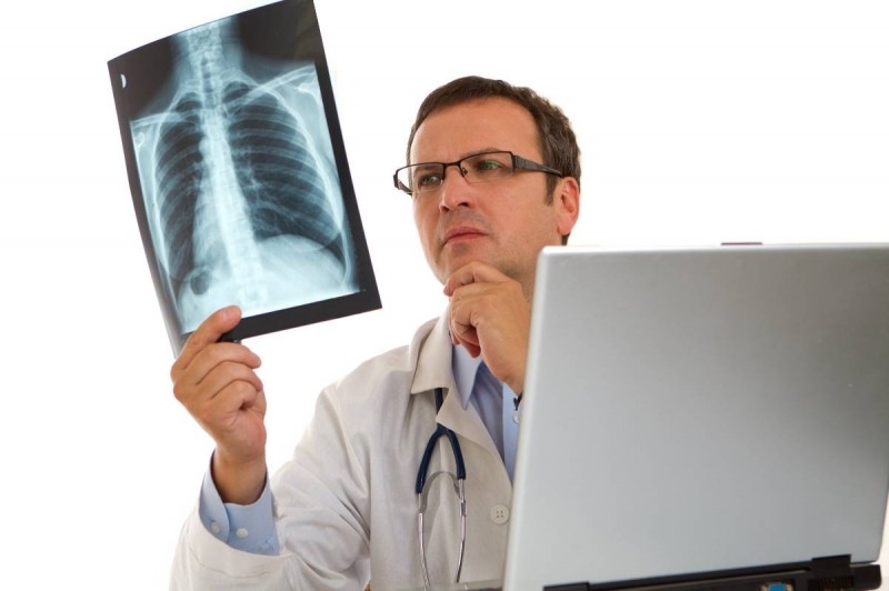 10 dấu hiệu nhận biết ung thư phổi giai đoạn đầu