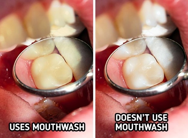 10 thói quen hàng ngày đang làm ố răng của bạn