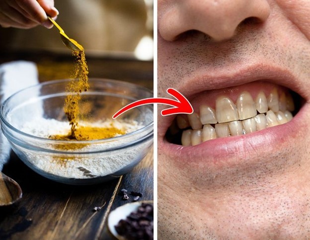 10 thói quen hàng ngày đang làm ố răng của bạn