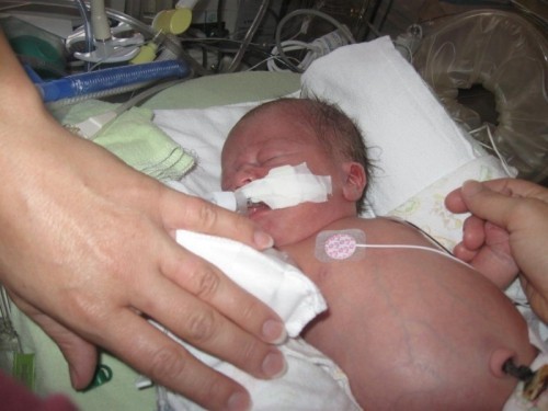 6 bệnh đường tiêu hóa hay gặp nhất ở trẻ sơ sinh và trẻ nhỏ