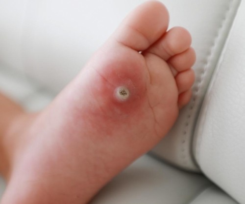 8 bệnh da liễu thường gặp nhất ở trẻ nhỏ