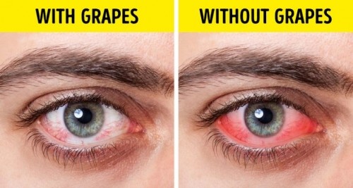 10 mẹo đơn giản giúp chữa bệnh khô mắt vô cùng hiệu quả