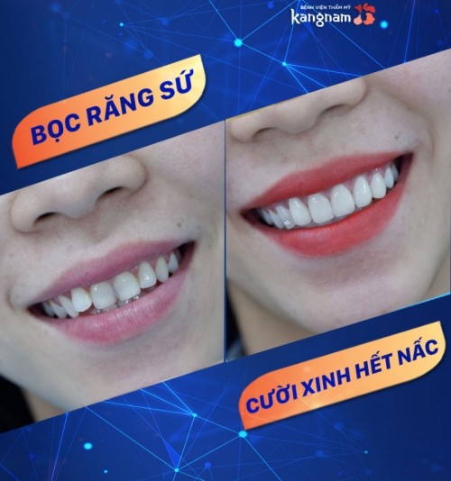 10 địa chỉ thẩm mỹ răng sứ đẹp và chất lượng nhất tại Hà Nội