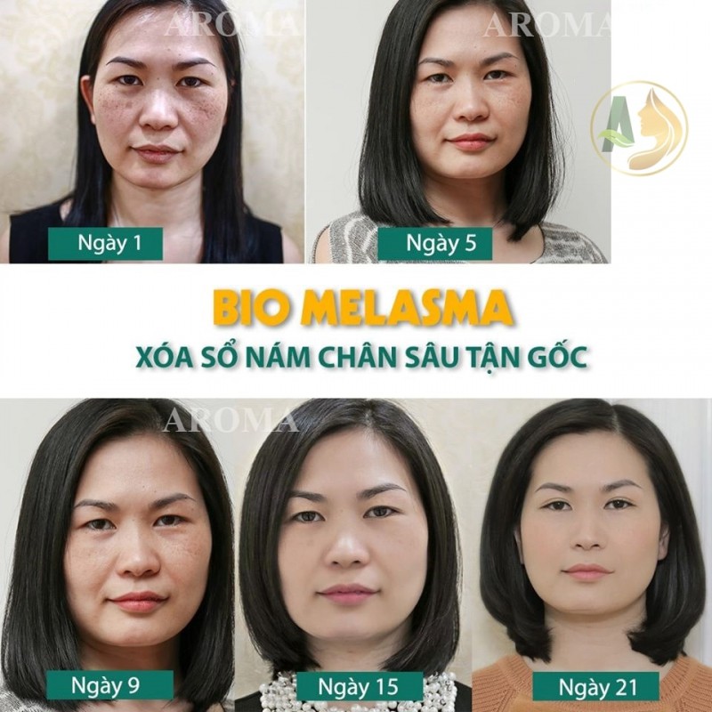 10 Spa trị nám tốt nhất TP. Việt Trì, Phú Thọ