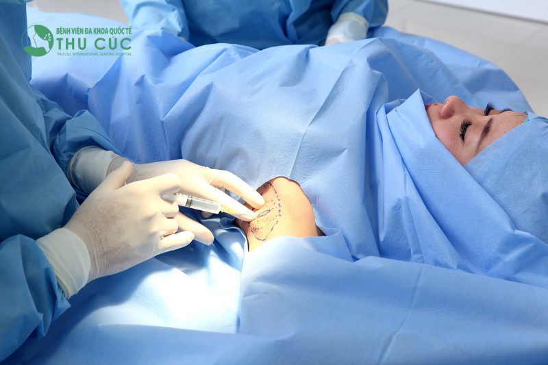 10 địa chỉ phẫu thuật nâng ngực uy tín nhất tại hà nội