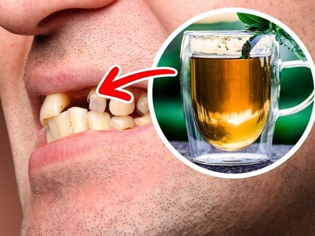 10 thực phẩm gây hại nghiêm trọng cho răng của bạn