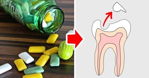 10 thực phẩm gây hại nghiêm trọng cho răng của bạn