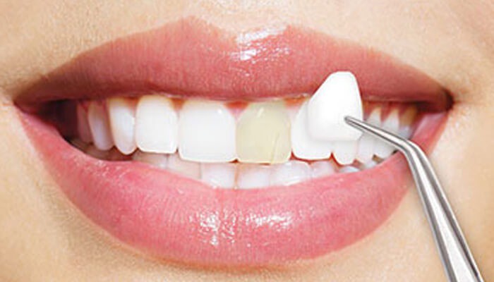 8 câu hỏi phổ biến nhất về chăm sóc răng miệng mà các nha sĩ thường nhận được