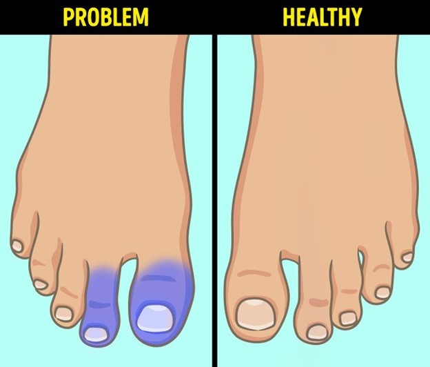 6 dấu hiệu ở chân có thể cảnh báo về tình hình sức khỏe của bạn