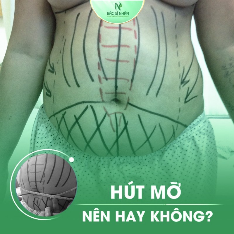 10 spa có dịch vụ giảm béo hiệu quả, an toàn nhất Đà Nẵng