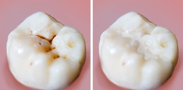 8 Sai lầm về chăm sóc răng miệng chúng ta thường mắc phải