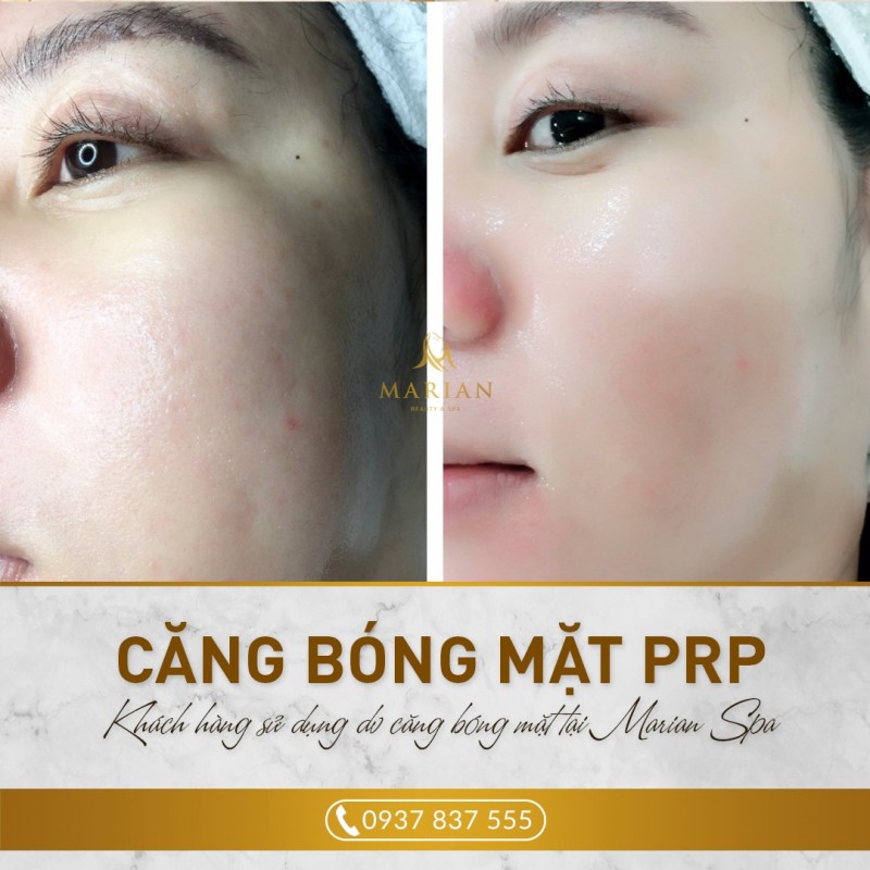5 Spa chăm sóc da mặt tốt nhất tại quận Cầu Giấy, Hà Nội