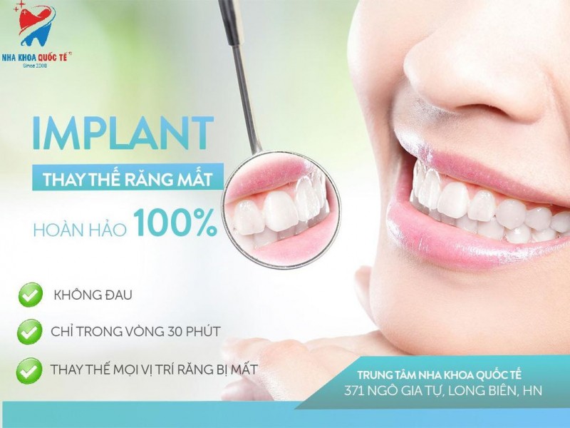 9 Địa chỉ trồng răng implant uy tín nhất quận Long Biên, Hà Nội