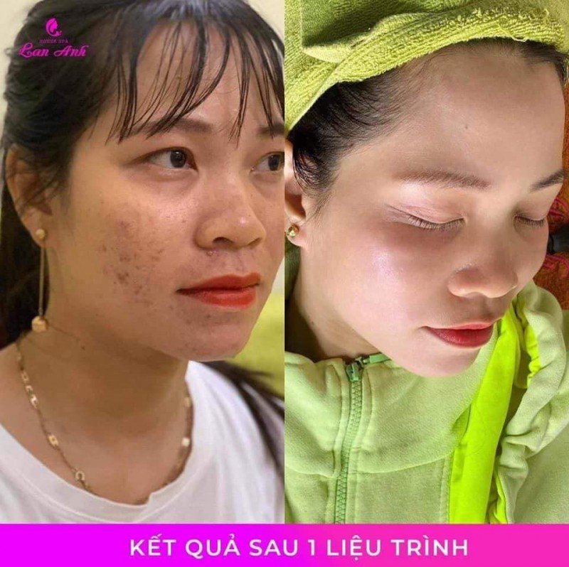 9 spa làm đẹp uy tín và chất lượng nhất cà mau