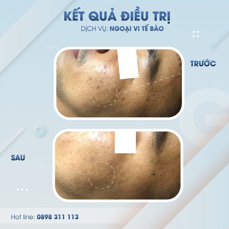 8 spa làm đẹp uy tín và chất lượng nhất quy nhơn, bình định