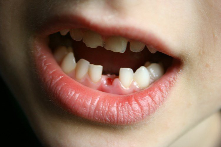10 lưu ý quan trọng nhất về sức khỏe răng miệng cho trẻ em
