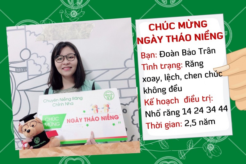 8 Địa chỉ niềng răng uy tín nhất quận Bình Thạnh, TP. HCM