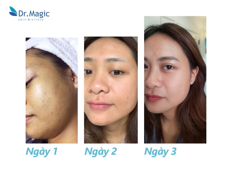 Top 10 Spa chăm sóc da mặt tốt ở Hà Nội được chị em lựa chọn nhiều nhất