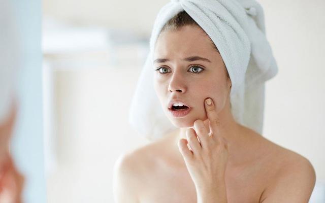 Cách chăm sóc da khi bị dị ứng mỹ phẩm đơn giản, phục hồi nhanh chóng