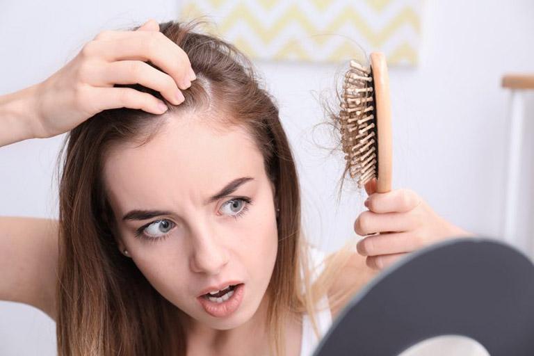 gợi ý cách khắc phục tóc rụng tại nhà, lấy lại vẻ tự tin cho mái tóc