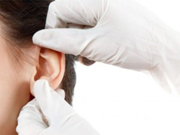 cách chữa ù tai: 3 mẹo nhỏ không cần dùng đến thuốc
