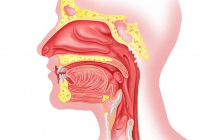 Những bệnh thông thường về tai mũi họng mọi người nên biết