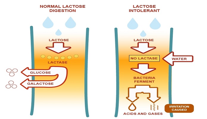 lactose là gì? những điều cần biết khi cơ thể bất dung nạp lactose
