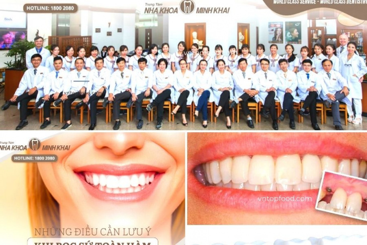 khám phá, trải nghiệm, 20 nha khoa gần đây làm răng, niềng răng, cắm implant uy tín tốt nhất