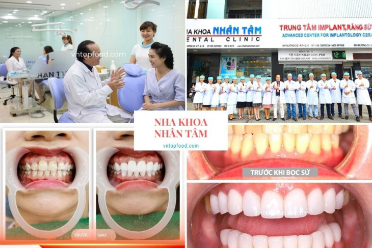 khám phá, trải nghiệm, 20 nha khoa gần đây làm răng, niềng răng, cắm implant uy tín tốt nhất