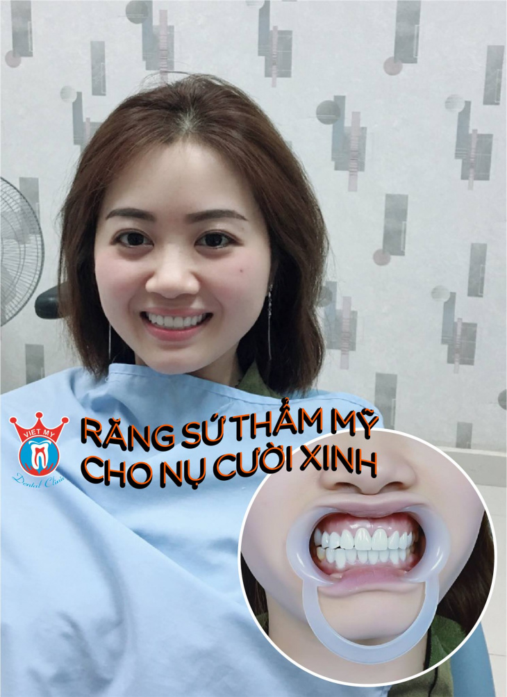 Top 8 địa chỉ bọc răng sứ chất lượng nhất Quảng Bình