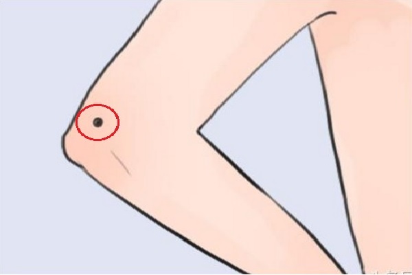 khám phá, nốt ruồi ở khuỷu tay trái, phải của đàn ông, phụ nữ có ý nghĩa gì?