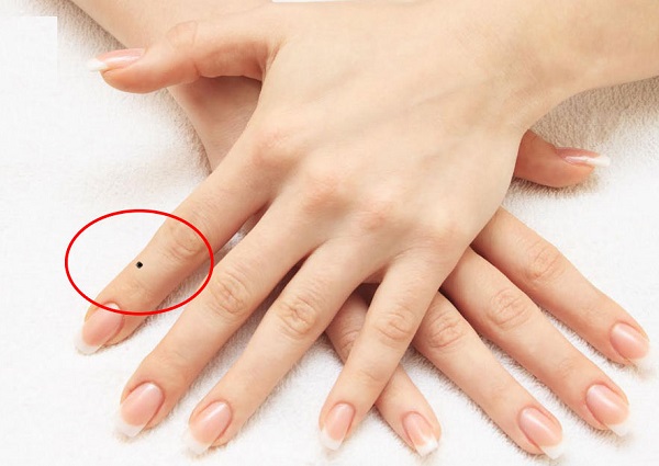 Nốt ruồi ở ngón tay trỏ nói lên điều gì? Tốt hay xấu? Có nên tẩy không?