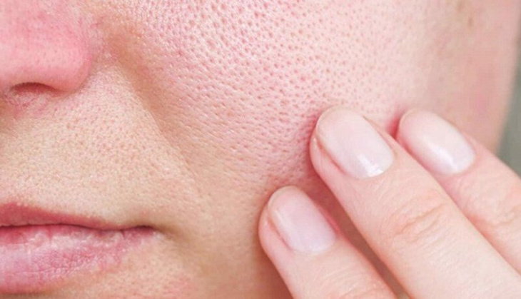 10 cách chăm sóc da lỗ chân lông to hiệu quả tại nhà