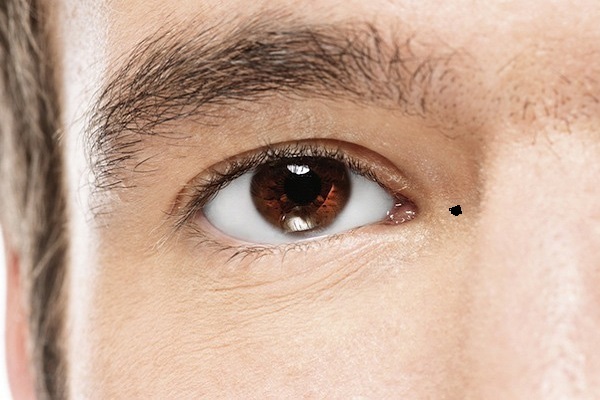 khám phá, nốt ruồi ở khóe mắt có ý nghĩa gì? tốt hay xấu?