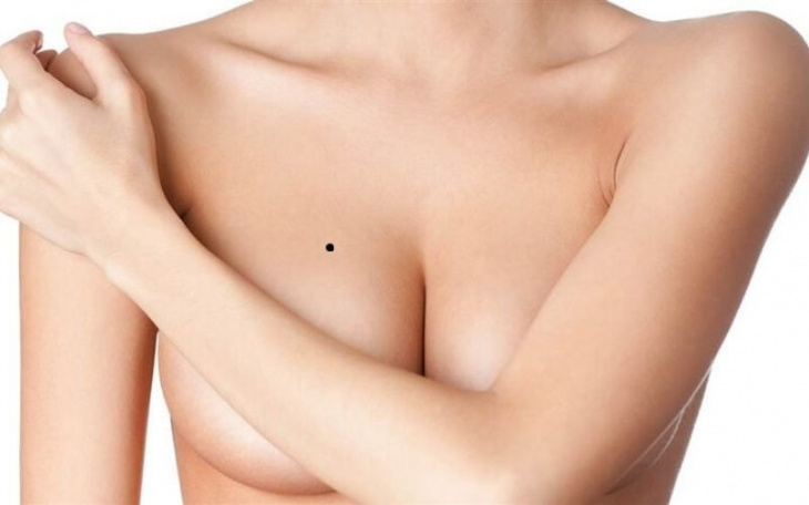 Nốt ruồi ở ngực phụ nữ trái, phải nói lên điều gì?