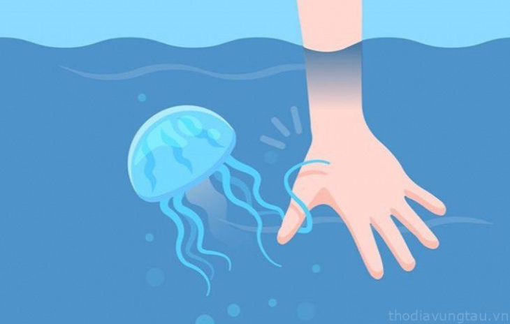 khám phá, trải nghiệm, hướng dẫn cách chữa trị sứa biển cắn
