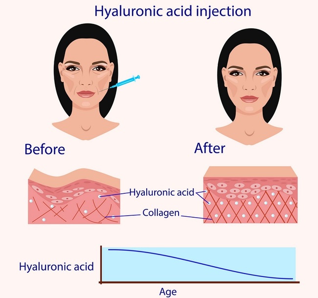 khám phá, trải nghiệm, hyaluronic acid là gì? hyaluronic acid (ha) có tác dụng gì?