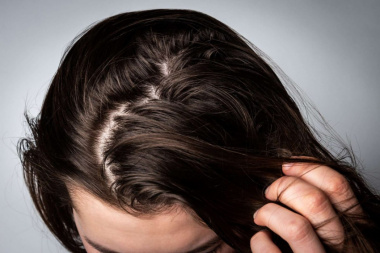 3 cách chữa tóc bết tại nhà cực hiệu quả