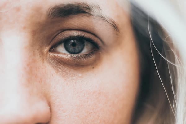 9 típ trị thâm mắt đơn giản nhưng hiệu quả ngay tại nhà