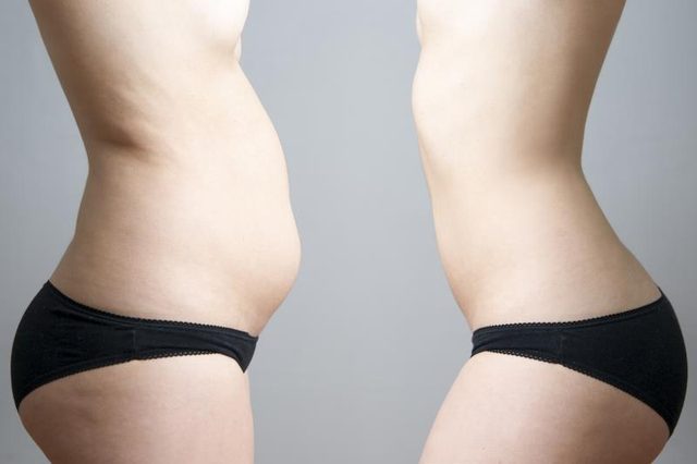 skinny fat là gì và cách khắc phục để có một vóc dáng chuẩn