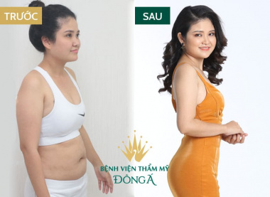 Top 10  Spa có dịch vụ giảm béo hiệu quả, an toàn nhất Đà Nẵng