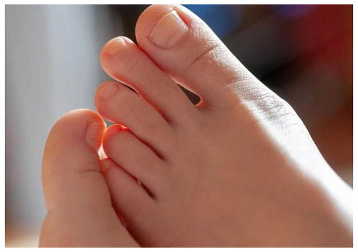 khám phá, ngón chân trỏ dài hơn ngón cái nói lên điều gì? ý nghĩa tướng số