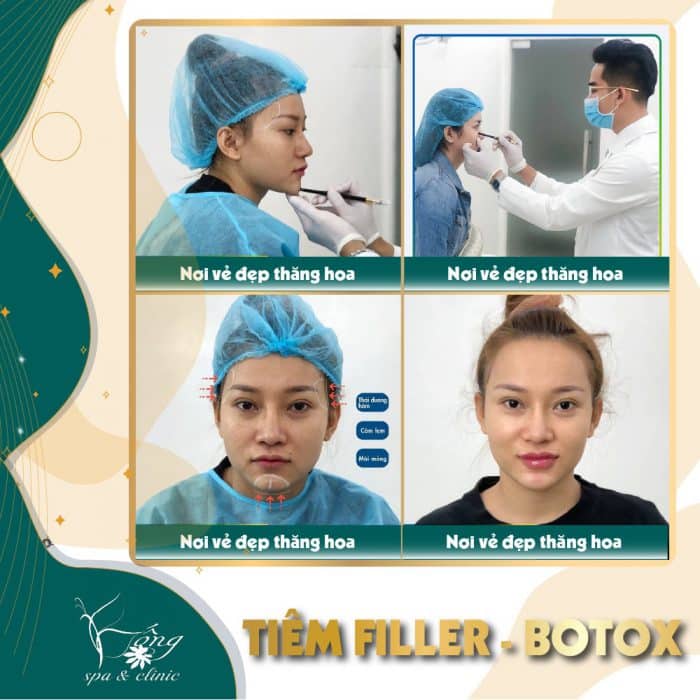 đà nẵng, viện thẩm mỹ anchee clinic – địa chỉ tiêm môi baby an toàn, lên phom chuẩn, đúng màu